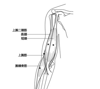 ボトックス画像2