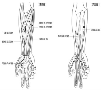 ボトックス画像3