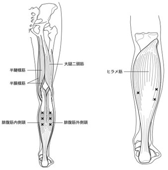 ボトックス画像4