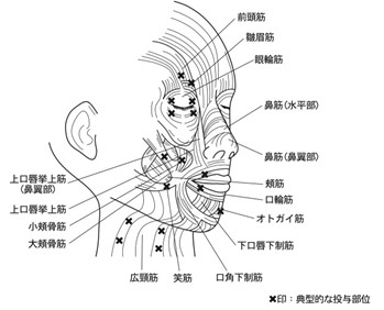 ボトックス画像6