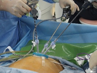 手術画像2