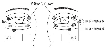 ボツリヌス治療外来 | 社会福祉法人あそか会 あそか病院